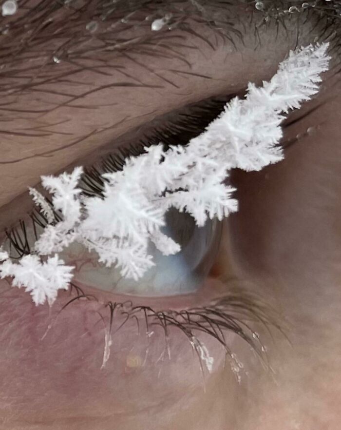 Close-up of an eye with ice crystals on eyelashes, showcasing the beauty of ice-cold winter conditions.