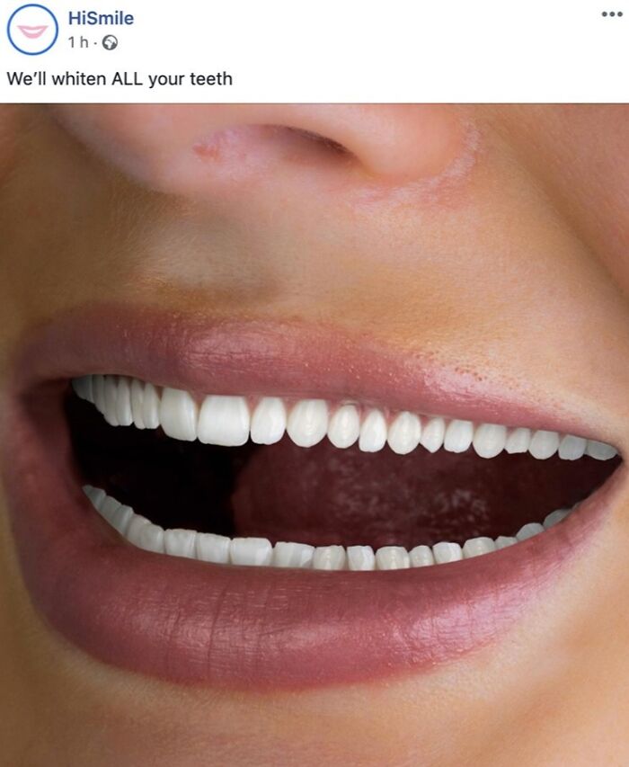 Close-up of a smile with extra teeth added, illustrating Funny-Ad-Fails in a humorous whitening product ad.