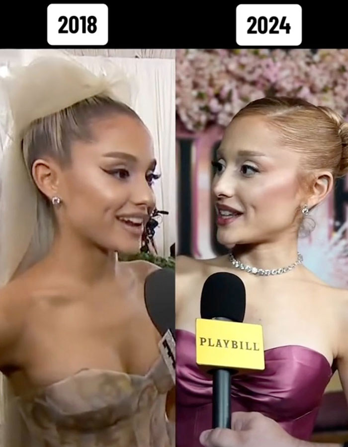 Ariana Grande Sparks New Health Concerns After Appearance At London Premiere Of ‘Wicked’