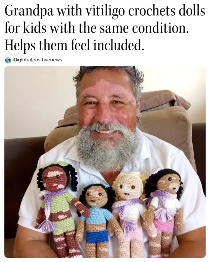 Man with vitiligo crochets inclusive dolls for kids, bringing uplifting stories of acceptance and joy.