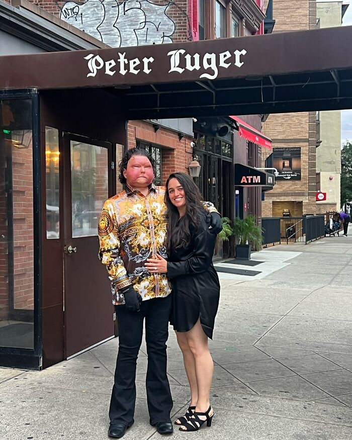 Man Who Had World’s First Face And Hands Transplant Shares Engagement Photos With Fiancée