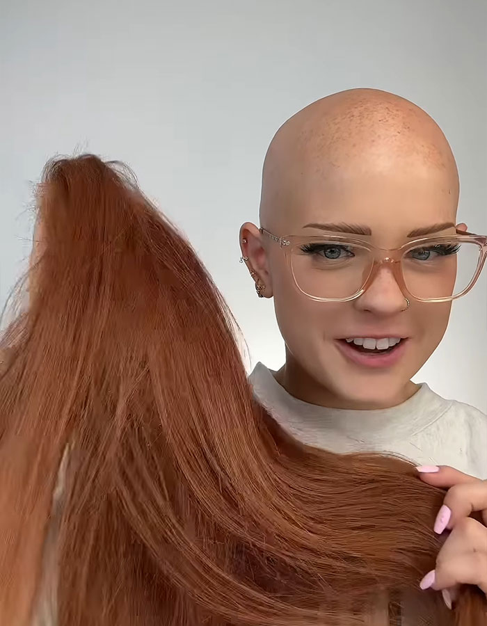 "You Have To Be Kidding Me": Makeup Artist With Alopecia Goes Viral With Stunning Transformations