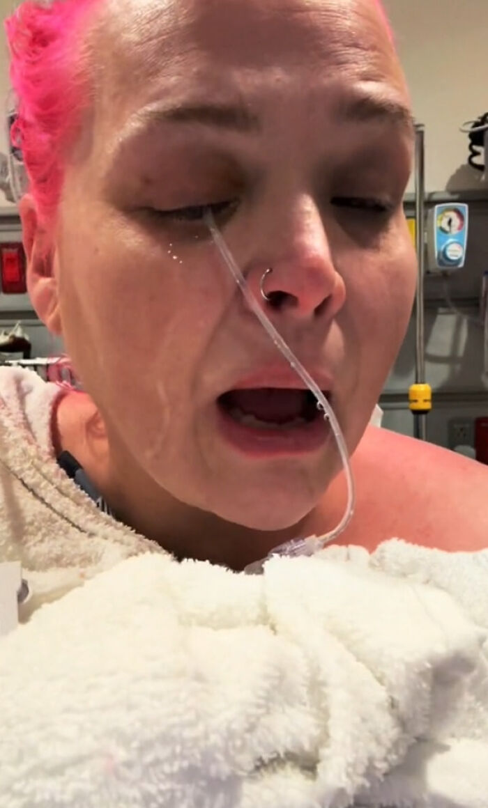 “I Started Screaming”: Woman Rushed To The Hospital After Mistaking Glue For Eye Drops