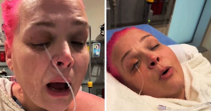 “I Started Screaming”: Woman Rushed To The Hospital After Mistaking Glue For Eye Drops