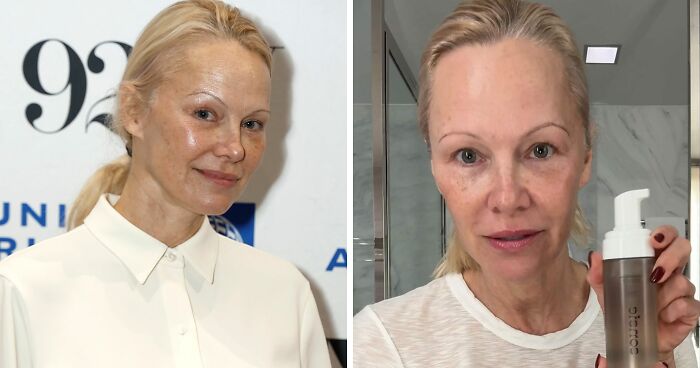 “Why Fillers But No Makeup?”: Pamela Anderson Slammed For Natural Appearance At NYC Screening