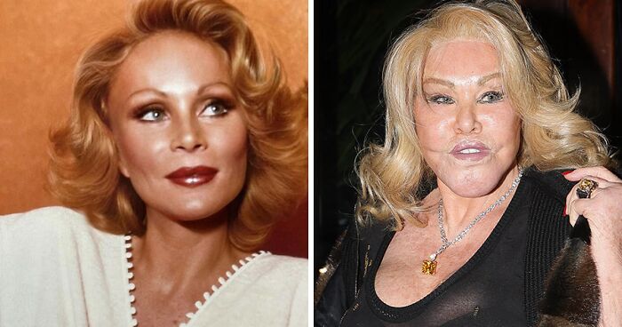 ‘Catwoman’ Jocelyn Wildenstein Says She’s Never “Had Plastic Surgery,” Calls Her Looks Natural