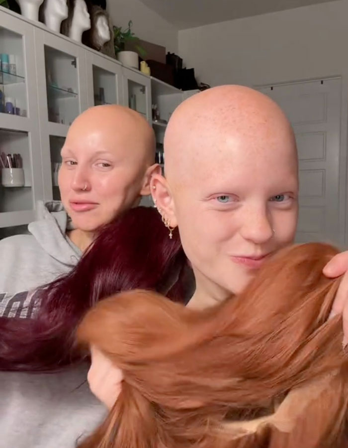 "You Have To Be Kidding Me": Makeup Artist With Alopecia Goes Viral With Stunning Transformations