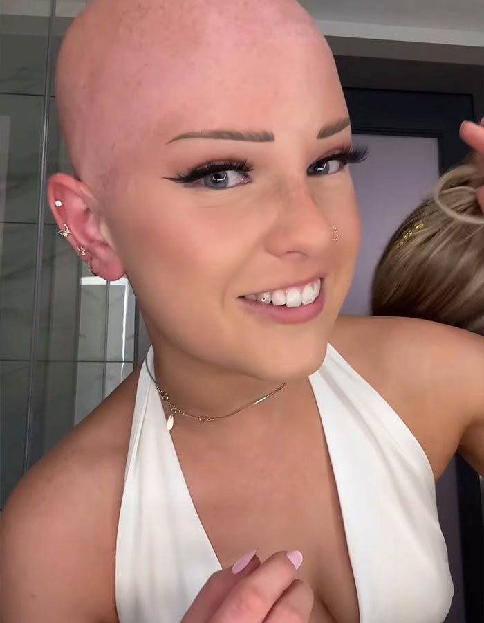 "You Have To Be Kidding Me": Makeup Artist With Alopecia Goes Viral With Stunning Transformations