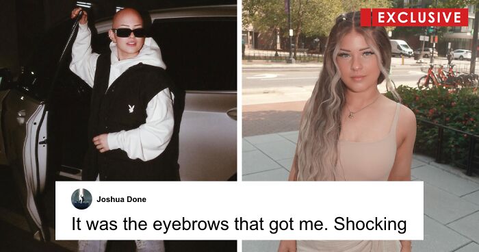 Makeup Artist With Alopecia, Who Defies Beauty Standards With Groundbreaking Talent, Opens Up