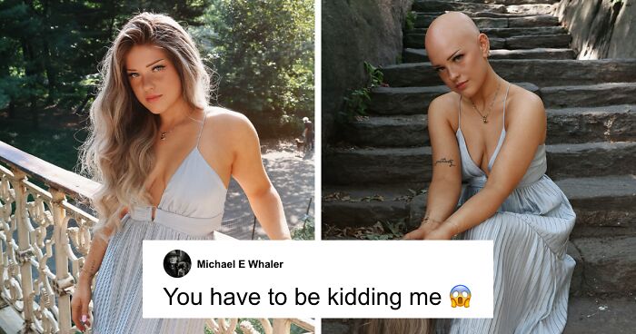 Professional Makeup Artist With Alopecia Exclusively Shares Journey To Internet Fame