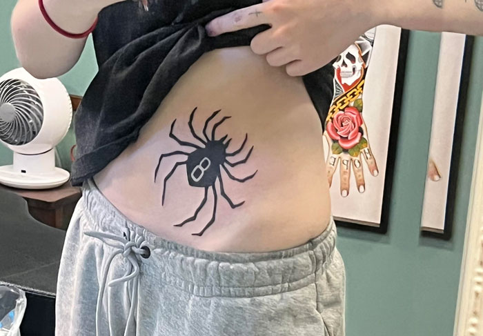 Lady In Two Minds After Nurse Saw Her Spider Tattoo And Fled, Wonders Whether To Give Honest Review