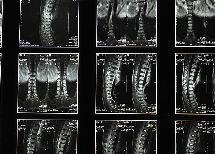 “Lived Like This Until 21”: 50 Times People Found Out Their Bodies Were Different From The ‘Norm’