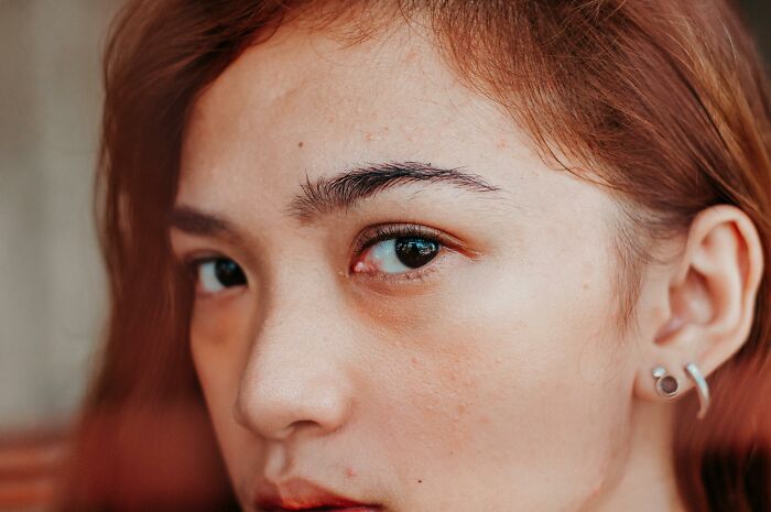 Close-up of a person's face, showcasing skin texture and expression, related to body alterations discussion.