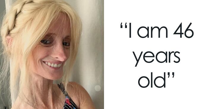 “Right Now Is All We Have”: 46-Year-Old Woman Lives In A Body Twice Her Age