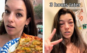 “Crazy”: Woman Ends Up In The ER With Swollen Face After Visiting Pickle-Themed Food Festival