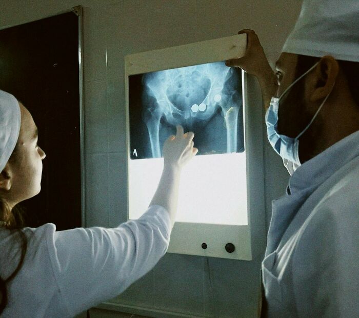 Doctors examining an X-ray on a lightbox, pointing out details related to abrupt job termination.