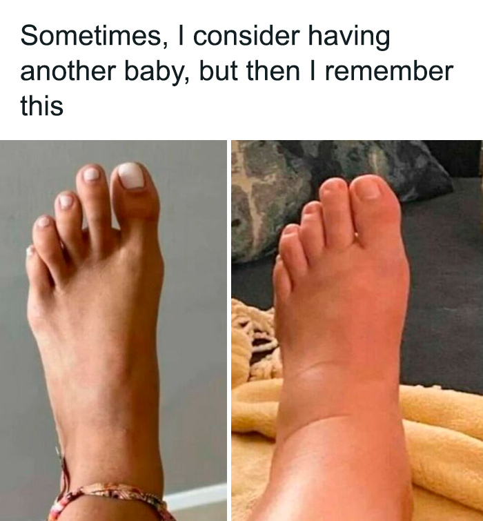 Two feet comparison meme highlighting the chaos of parenting; one foot is normal, the other is swollen.