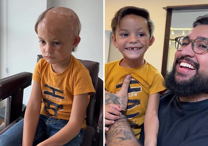 Brazilian barber provides hair prosthetics to a smiling child, transforming their appearance and boosting confidence.