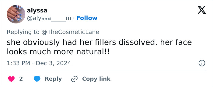 Tweet about Donatella Versace’s new face, with a comment on a natural look after dissolving fillers.