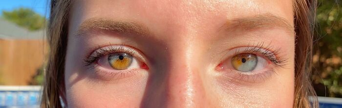 Close-up of eyes with different colors under sunlight, showcasing fascinating pics.