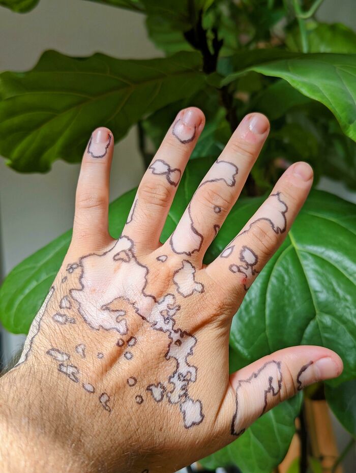 Hand with unique pigmentation patterns resembling a world map, set against green leaves; fascinating pic.