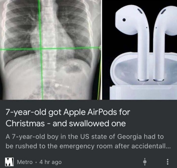 X-ray showing swallowed AirPod next to a pair of Apple AirPods, illustrating a Christmas accident.