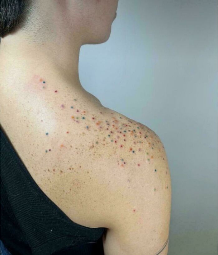 It Just Looks Like A Colorful Rash