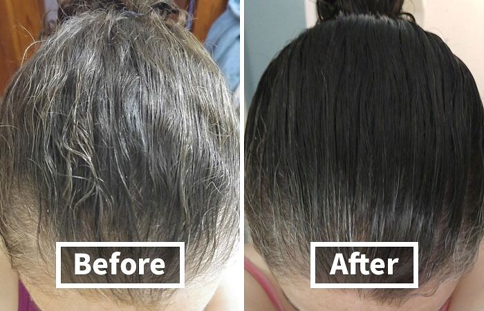 Before and after image showing hair transformation using a product from Amazon.