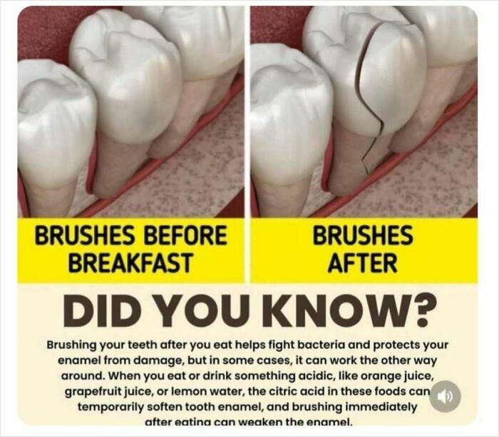 Image comparing teeth health: brushing before breakfast vs. after, highlighting dental facts and curiosities.