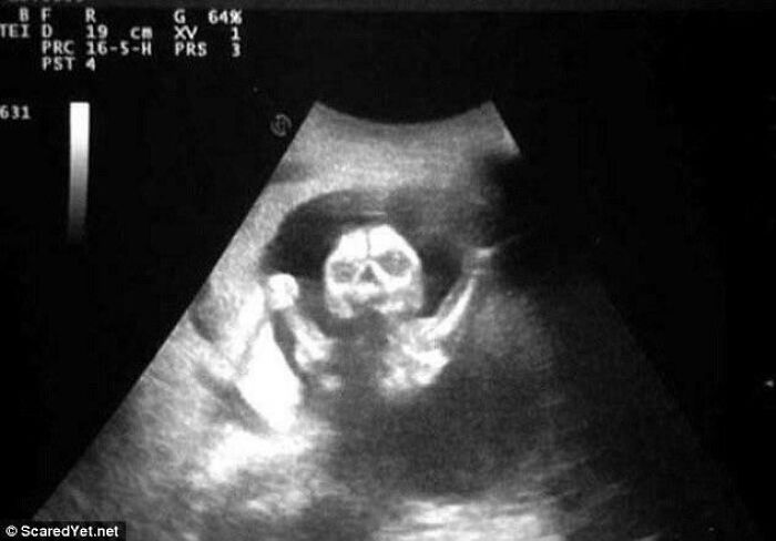 What Shall I Name My Baby Based On His Scan