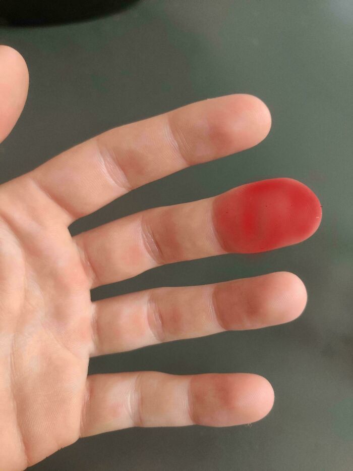 Luckily I Didn't Hurt My Finger, But I Edited It And Colored It Red