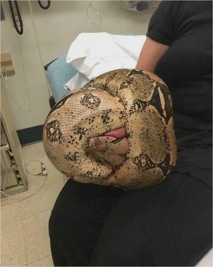 A large snake coiled on a person's lap in a medical setting, showcasing interesting medical cases involving the human body.