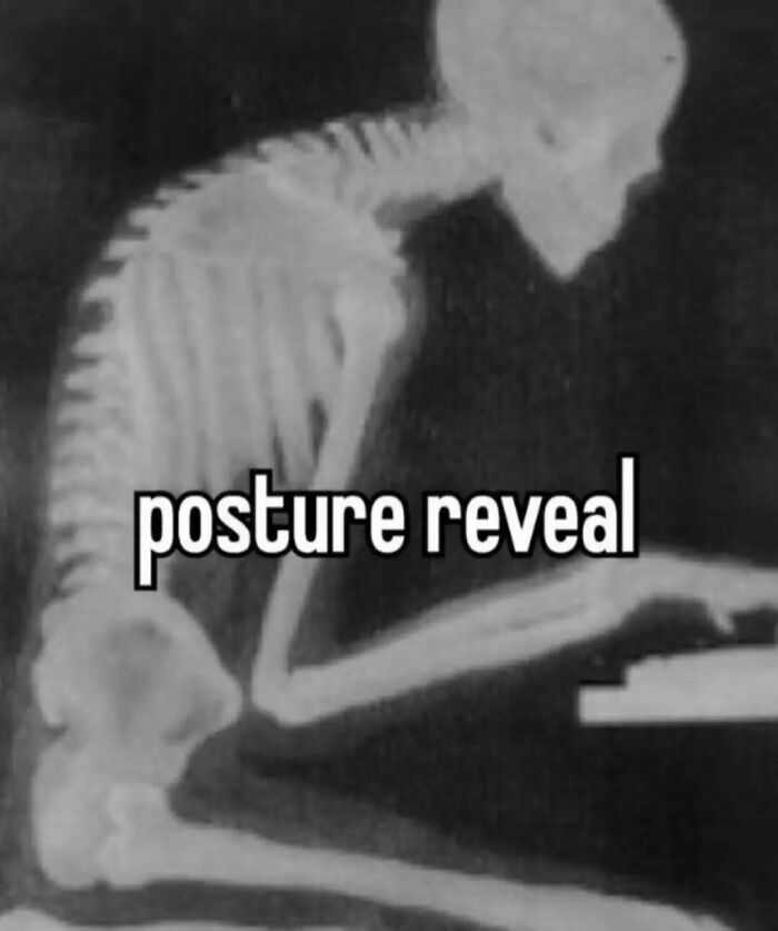 X-ray of a skeleton slouched over a desk with text "posture reveal," highlighting relatable mental health memes.