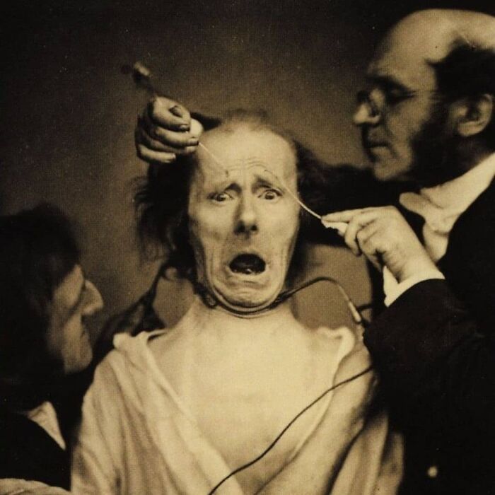 Two men performing an early electrical experiment on a man's face, showcasing historical scientific practices.