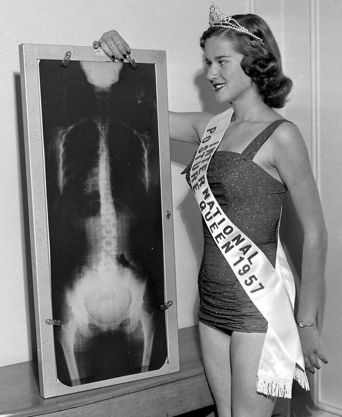 Beauty queen from 1957 showcasing an X-ray in a historical photograph with a sash and crown.