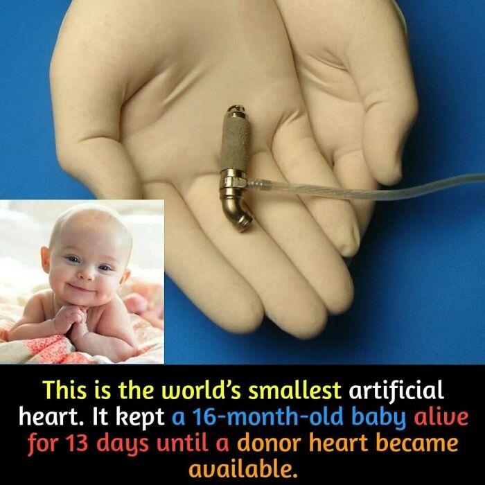 Smallest artificial heart in a gloved hand with a photo of a smiling baby, highlighting surprising medical advancement.