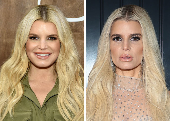 Celebrity Faces Show Alarming Effects Of Ozempic Use As Hollywood Grapples With New Beauty Fad