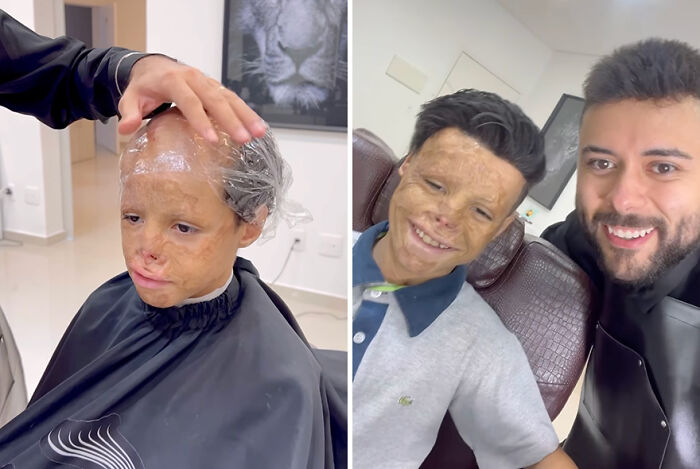 Brazilian barber creates hair prosthetics for kids, showing before and after transformation in the salon.