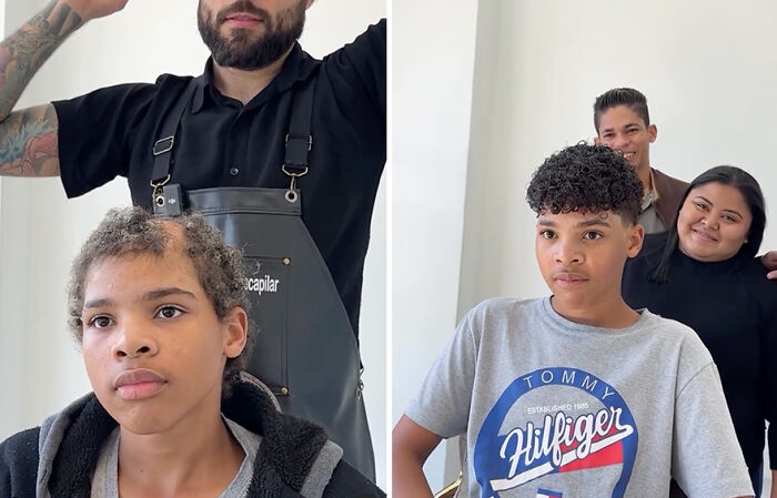 Brazilian barber gives hair prosthetics to a young boy, showing transformation from before to after the procedure.