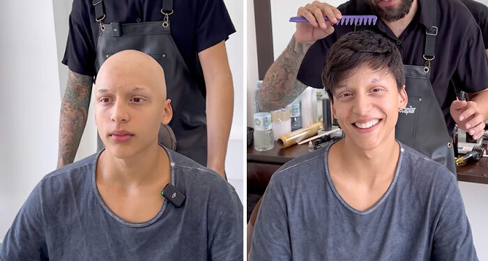 Brazilian barber provides hair prosthetics for kids; a before-and-after transformation shows a boy smiling post-treatment.