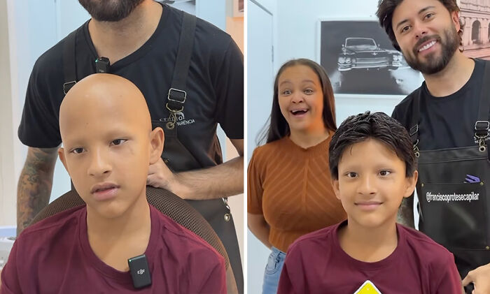 Brazilian barber gives hair prosthetic to child, showing before and after transformation.