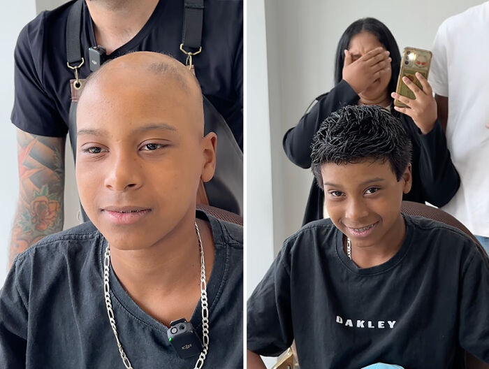 Brazilian barber gives hair prosthetics to child with hair loss, showing transformation and joy.