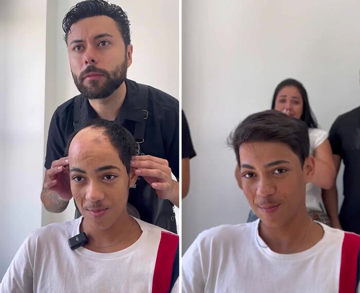 Brazilian barber fitting hair prosthetic on a young boy, showing before and after transformation.