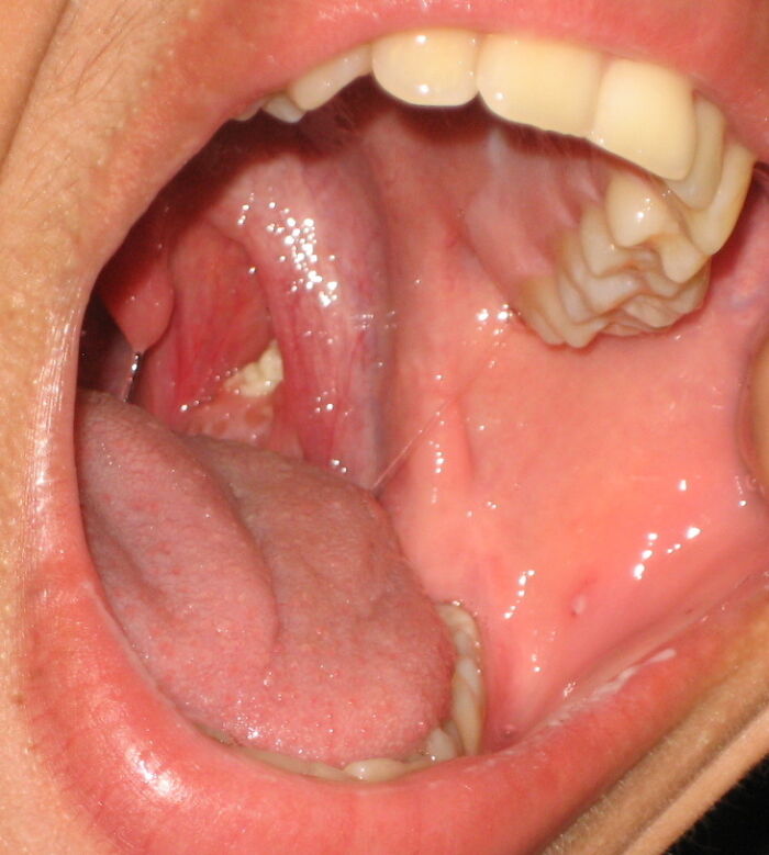 Close-up of an open mouth showing healthy teeth and tongue, emphasizing good hygiene habits.