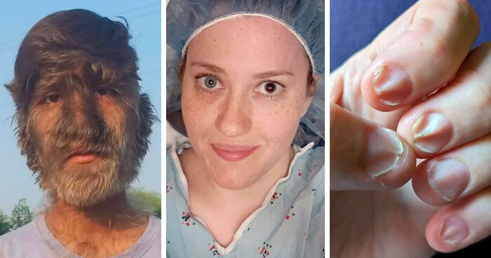 59 Fascinating Medical Stories That Prove Truth Is Stranger Than Fiction (New Pics)