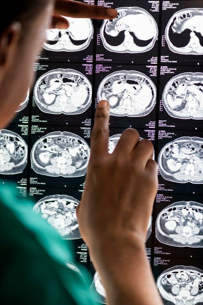 Person examining X-ray scans, possibly indicating a terrible Christmas incident.