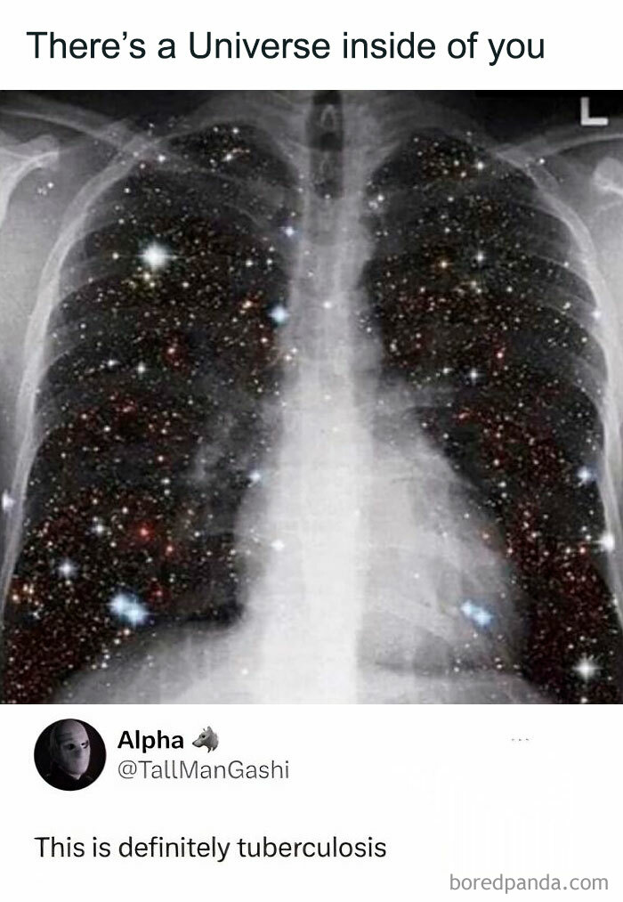 X-ray of a chest filled with stars captioned, "There's a Universe inside of you," with a humorous tweet below.