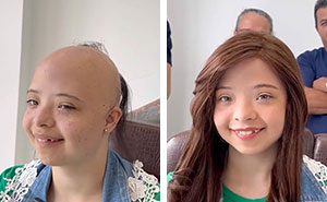 Heartwarming Transformations: 20 Pictures Of Kids Receiving Hair Prosthetics From This Barber