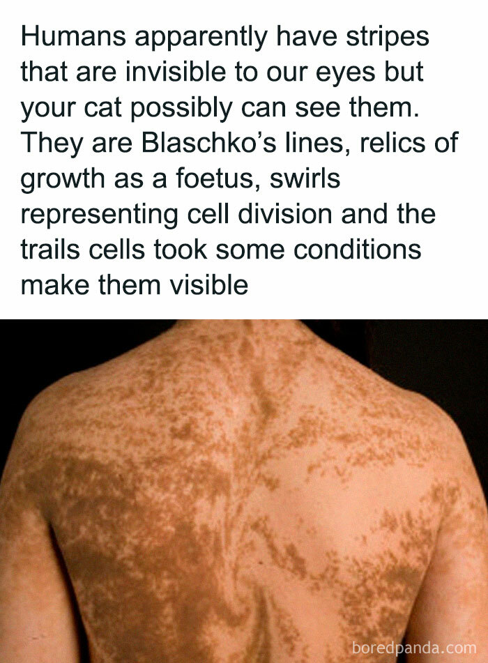 Human back showing Blaschko's lines, highlighting peculiar skin patterns related to growth and cell division.