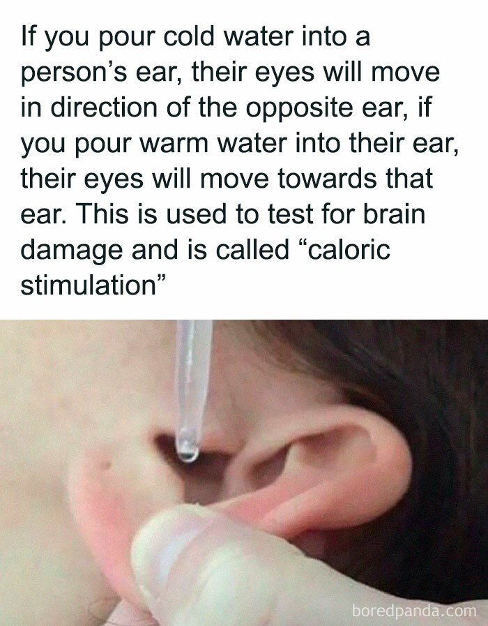 Caloric stimulation test with water dropper in ear, demonstrating one of 89 facts and curiosities about how everything works.